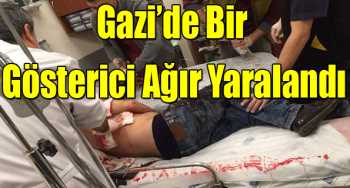 Gazi’de Bir Gösterici Ağır Yaralandı